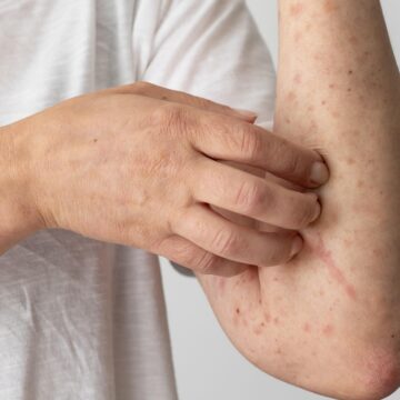 Doctor diagnoses cause of patient’s chronic pain to be a 10-year-old tick bite: ‘More antibiotics don’t help’