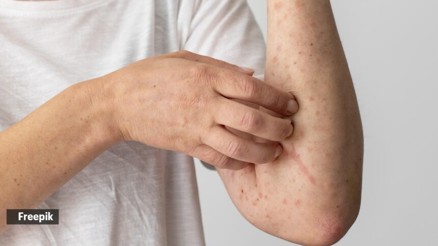 Doctor diagnoses cause of patient’s chronic pain to be a 10-year-old tick bite: ‘More antibiotics don’t help’