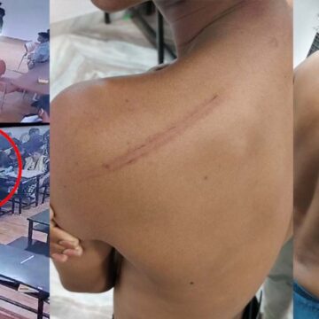 ரத்தம் சொட்ட சொட்ட சித்ரவதை செய்யப்பட்ட நீட் மாணவர்கள்… சிசிடிவியில் பகீர்!