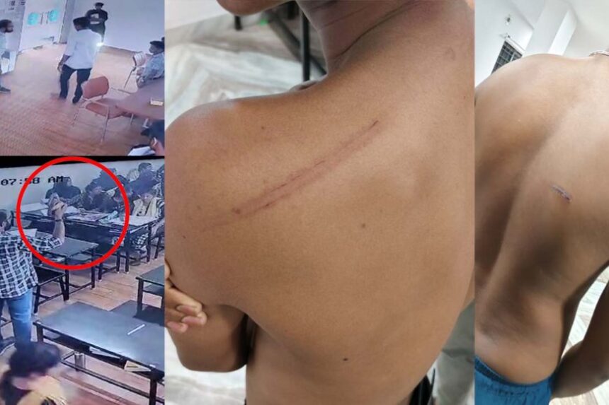 ரத்தம் சொட்ட சொட்ட சித்ரவதை செய்யப்பட்ட நீட் மாணவர்கள்… சிசிடிவியில் பகீர்!