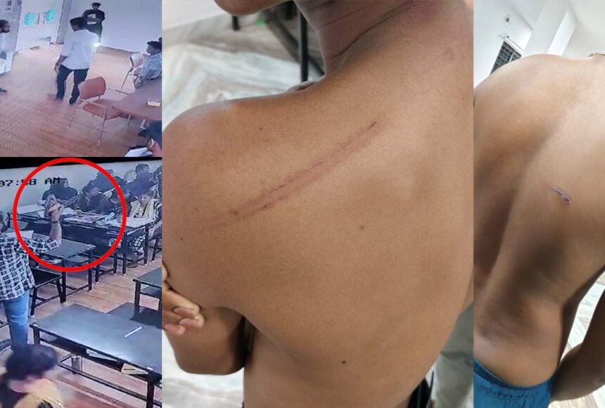 ரத்தம் சொட்ட சொட்ட சித்ரவதை செய்யப்பட்ட நீட் மாணவர்கள்… சிசிடிவியில் பகீர்! ரத்தம் சொட்ட சொட்ட சித்ரவதை செய்யப்பட்ட நீட் மாணவர்கள்… சிசிடிவியில் பகீர்!