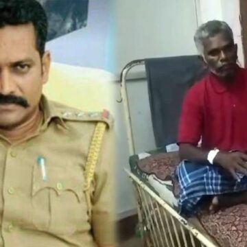 விசாரணைக்கு சென்ற பேராசிரியர் பற்களை உடைத்த காவல் ஆய்வாளர்- நடவடிக்கை எடுக்க கோரிக்கை விசாரணைக்கு சென்ற பேராசிரியர் பற்களை உடைத்த காவல் ஆய்வாளர்- நடவடிக்கை எடுக்க கோரிக்கை