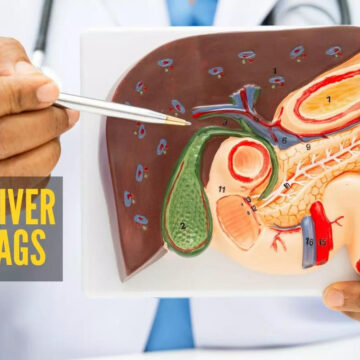 Fatty Liver Warning Signs: Don't Ignore These 8 Symptoms Fatty Liver Warning Signs: Don’t Ignore These 8 Symptoms