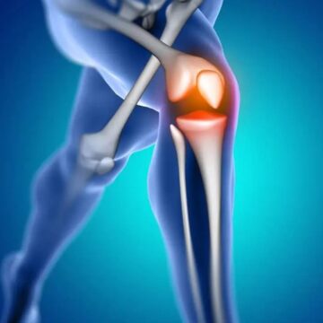 ‘Joints’ friend, not some magic fix’: Orthopaedic clarifies whether turmeric helps maintain cartilage health, recommends ways to keep knee pain away in your 40s and 50s