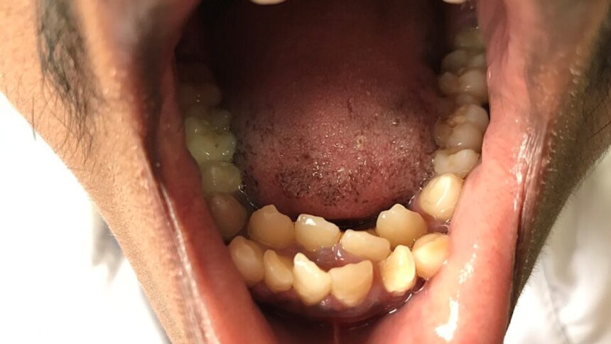 This rare condition left an 11-year-old with 81 teeth; dentist says ‘most people don’t realise until…’