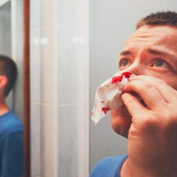 Why some nosebleeds require emergency room visits, and what makes them more serious than others
