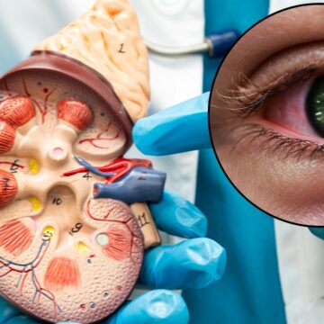 Women visits doctor for eye problem, finds out her kidneys are failing: ‘Within days, my entire world flipped…’