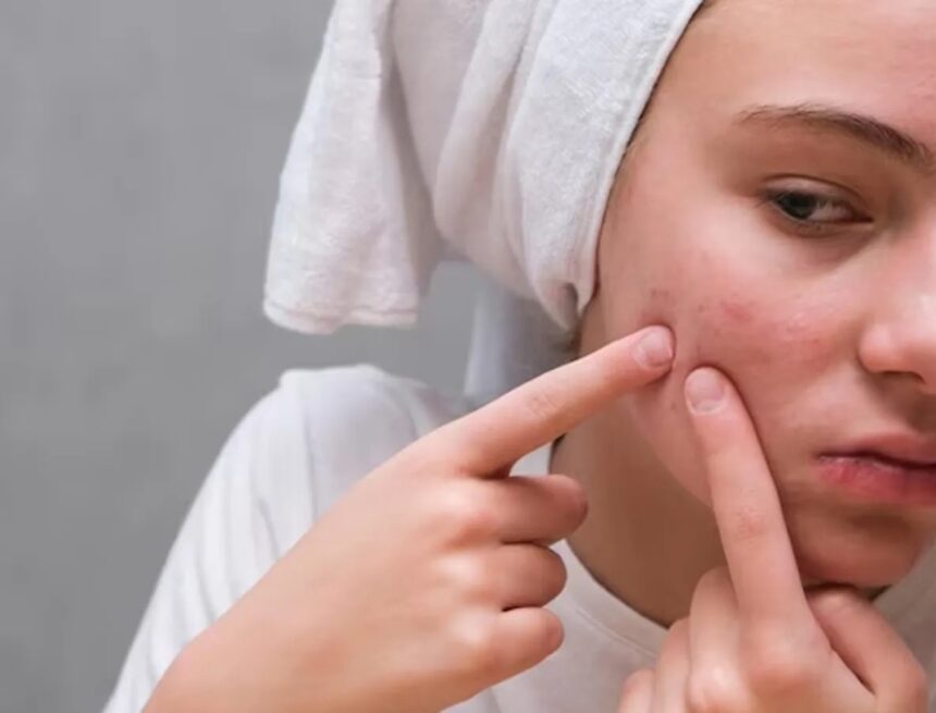 Doctor shares case of woman who came to get her ‘pimple’ treated — turned out to be autoimmune disorder: ‘It was red, painful, swollen…’