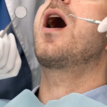 Why astronauts need to get their wisdom teeth removed before travelling to space