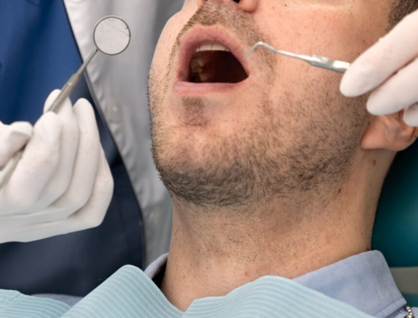 Why astronauts need to get their wisdom teeth removed before travelling to space