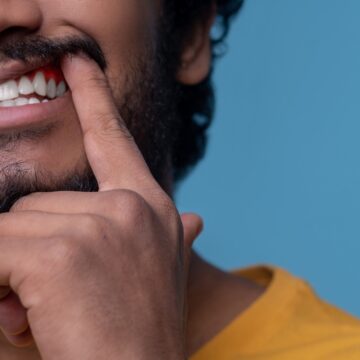 Oncologist shares case of non-tobacco related cancer in 21-year-old man with ‘sharp teeth,’ says ‘It could have been identified’