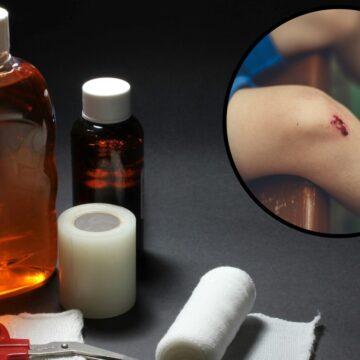 This is what happens if you apply expired antiseptic on wounds