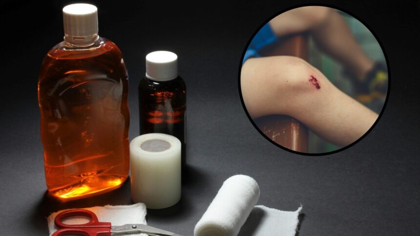 This is what happens if you apply expired antiseptic on wounds