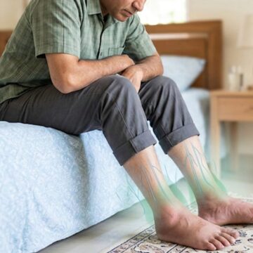 ‘It may indicate…’: Doctor explains why one leg being significantly more swollen than the other is a medical emergency you should not ignore