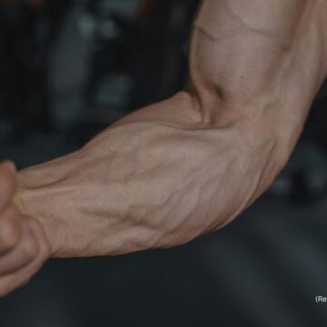 Why bulging veins could signal underlying circulation issues