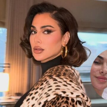 ‘An infection had started’: Huda Beauty founder opens up about ruptured breast implant, urges fans to get them ‘replaced every 10 years’