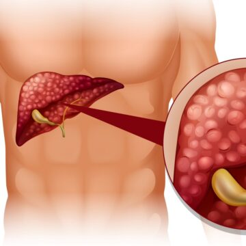 ‘I am newly diagnosed with cirrhosis. Can it be reversed?’