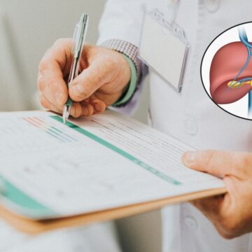 ‘I had a bilirubin total of 2.3mg/dl, but don’t have any symptoms. Could it be serious?’