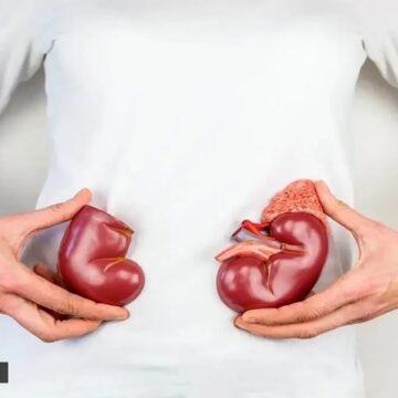 ‘My creatinine is 1.4, GFR is 39 and dropping rapidly; nephrologist said I have nothing to worry about now but in 10 years from now I’ll be on dialysis. Is this true?’