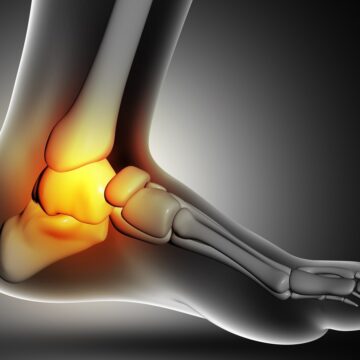 ‘Sitting slows your leg circulation’: Vascular surgeon shares the 30-second ankle exercise to cut poor circulation, swelling, and DVT risk