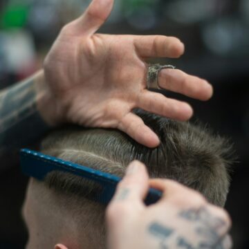 ‘Why do I have a receding hairline if I’m only 16 years old?’