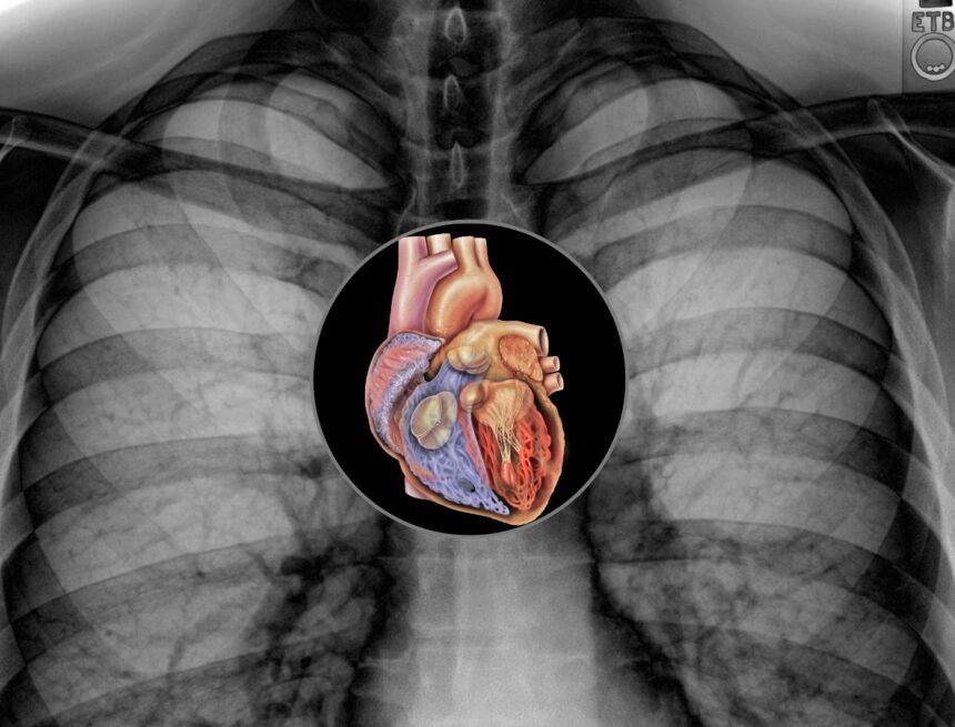 ‘It was found in an X-ray that my heart is bigger than normal, but doctor said it was just fine. What factors could make heart enlargement turn out to be fine?’