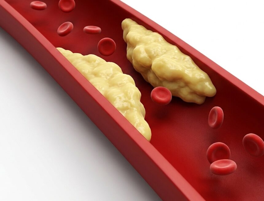 Doctor shares habits that may naturally help lower ‘bad’ cholesterol