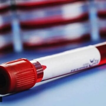 Fasted 13 hours instead of 8-12 for a blood sugar test: Does it matter?