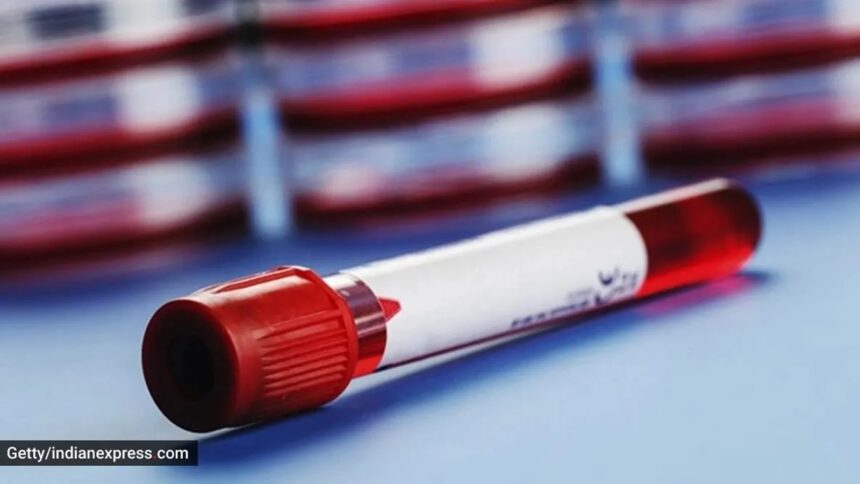 Fasted 13 hours instead of 8-12 for a blood sugar test: Does it matter?