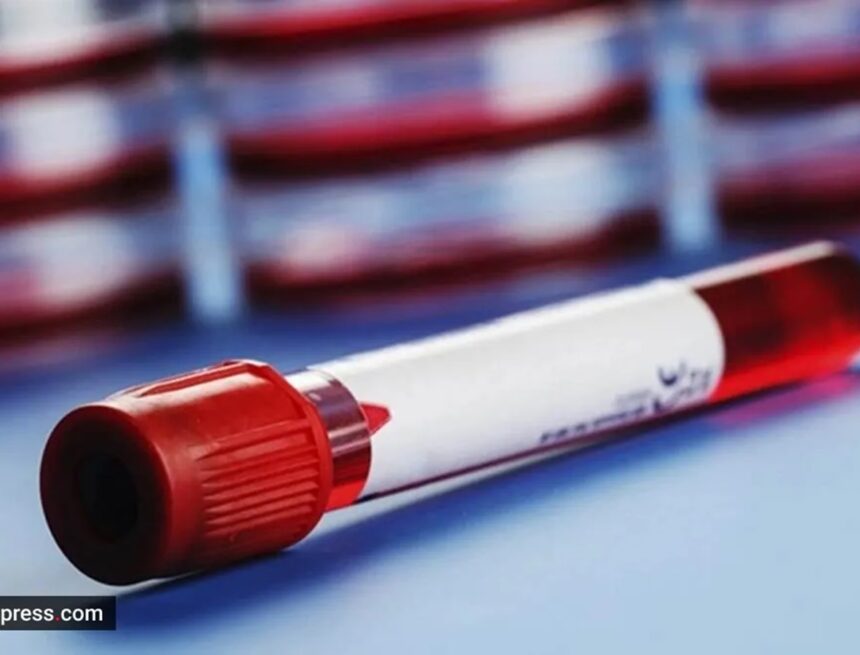 Fasted 13 hours instead of 8-12 for a blood sugar test: Does it matter?
