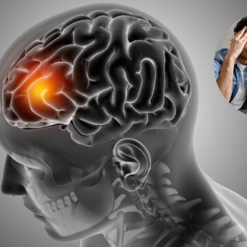 If your headache comes with these symptoms — don’t ignore it