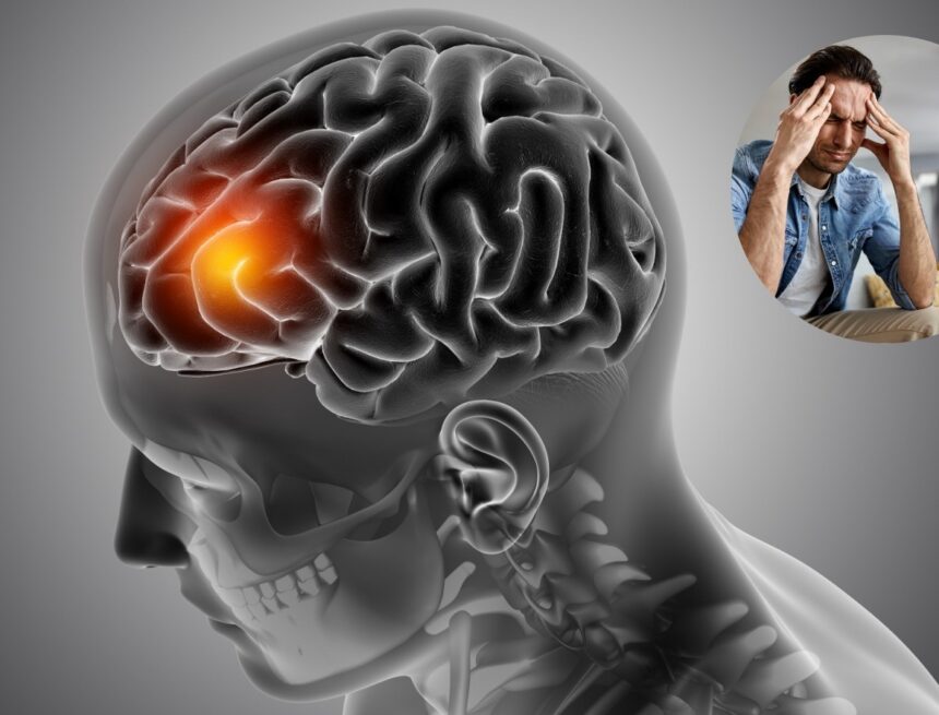 If your headache comes with these symptoms — don’t ignore it