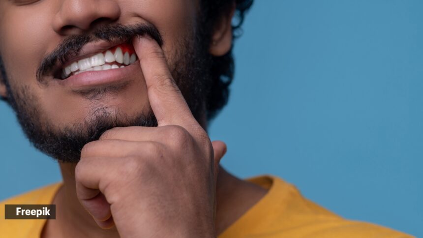 Mouth ulcer that wouldn’t heal: Why doctor warns against ignoring persistent oral symptoms
