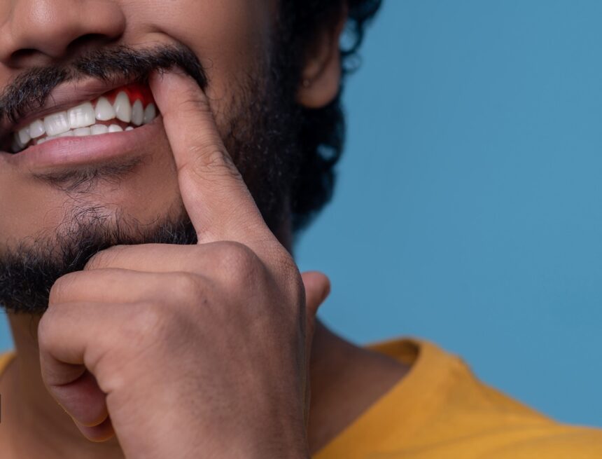 Mouth ulcer that wouldn’t heal: Why doctor warns against ignoring persistent oral symptoms