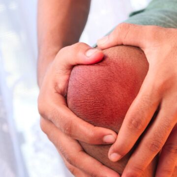The summer habit that may be making joint pain worse