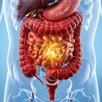 How the gut microbiome changes after 45 and why it matters for your health