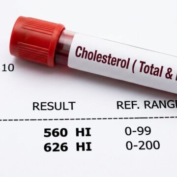 New once-daily pill to lower bad cholesterol approved by FDA: how it works and who may benefit New once-daily pill to lower bad cholesterol approved by FDA: how it works and who may benefit