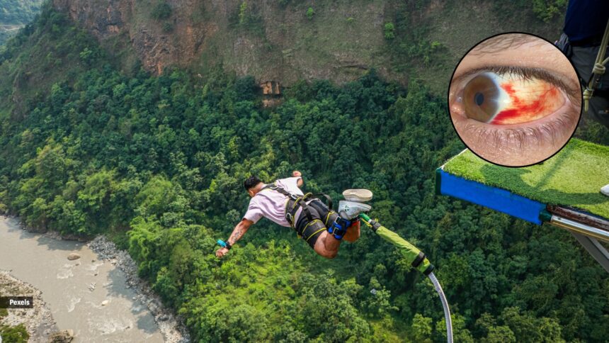 Your eyes may turn red after bungee jumping — here’s what is happening Your eyes may turn red after bungee jumping — here’s what is happening
