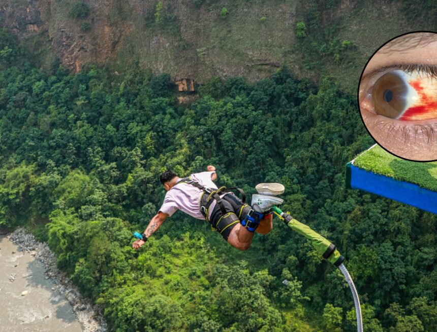 Your eyes may turn red after bungee jumping — here’s what is happening Your eyes may turn red after bungee jumping — here’s what is happening
