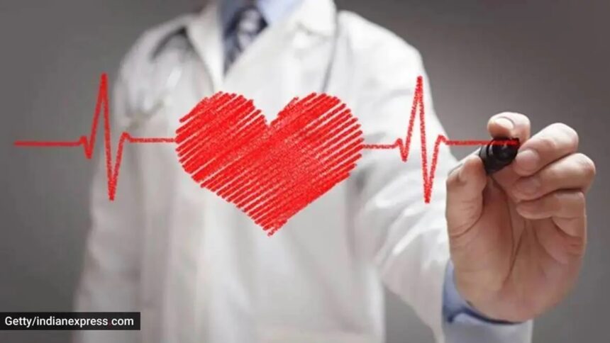 Primary, secondary or procedure-related: 3 new settings for classifying heart attacks explained Primary, secondary or procedure-related: 3 new settings for classifying heart attacks explained