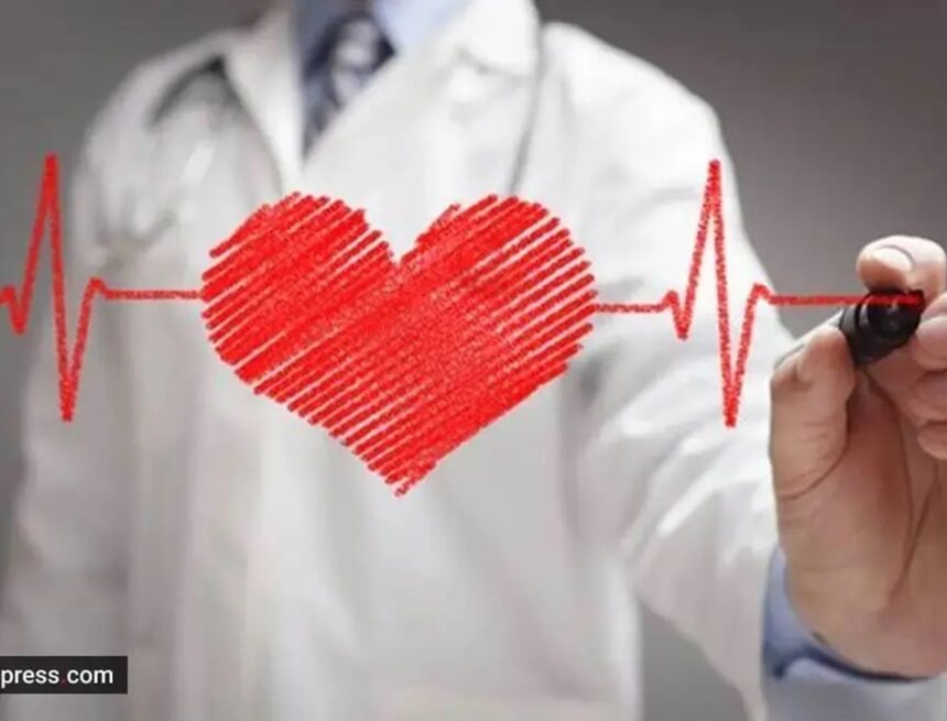 Primary, secondary or procedure-related: 3 new settings for classifying heart attacks explained