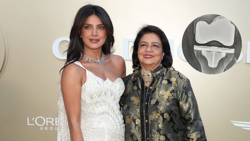 Priyanka Chopra’s mother Dr Madhu Chopra shares X-ray of her ‘beautiful new knee’