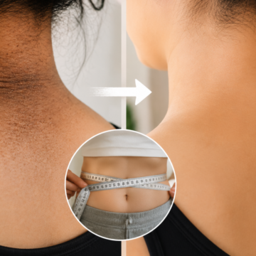 Two visible signs your insulin sensitivity may be improving