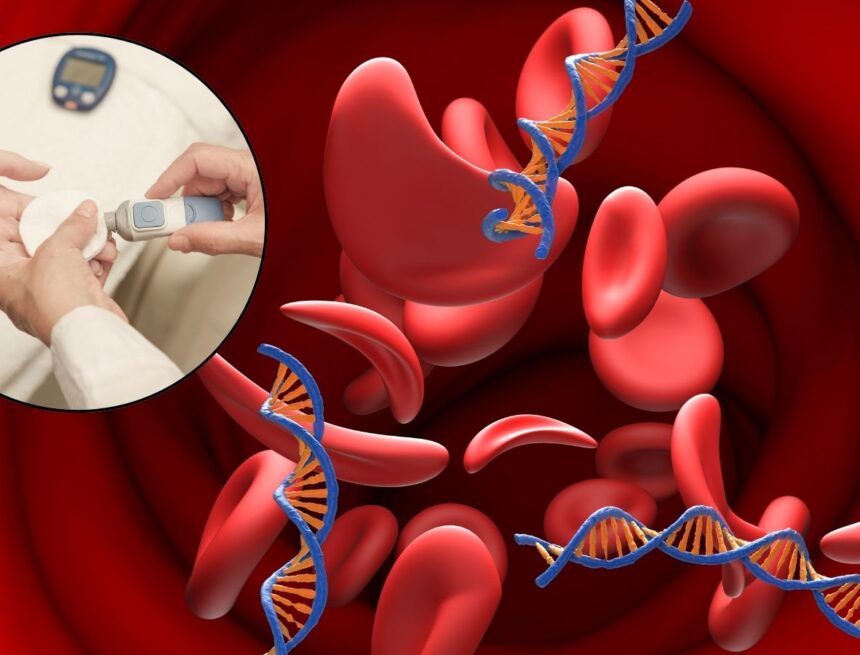 HbA1c and anaemia: Why your blood sugar test may not tell the full story
