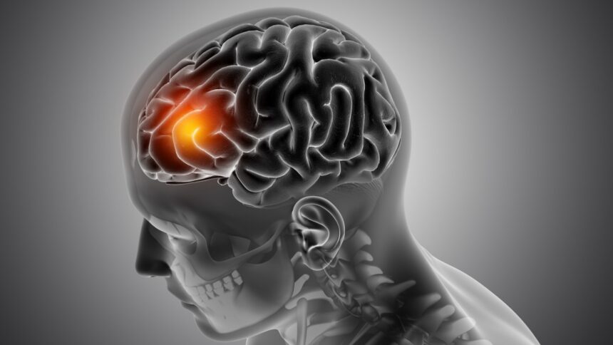 A 7-day checklist to lower cortisol is going viral: An endocrinologist weighs in A 7-day checklist to lower cortisol is going viral: An endocrinologist weighs in