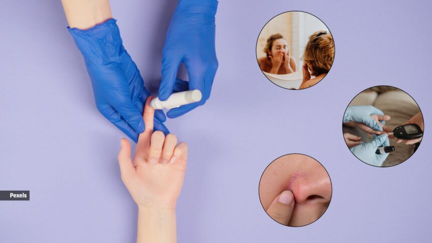 Can you really tell if someone has high blood sugar by looking at their face? Can you really tell if someone has high blood sugar by looking at their face?
