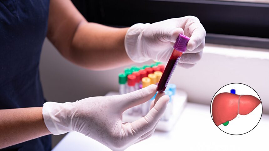 How to check your liver after quitting alcohol: 3 tests that matter