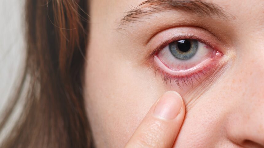 Visual Snow Syndrome: Why you see tiny dots across your field of vision